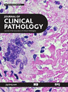 JOURNAL OF CLINICAL PATHOLOGY雜志封面